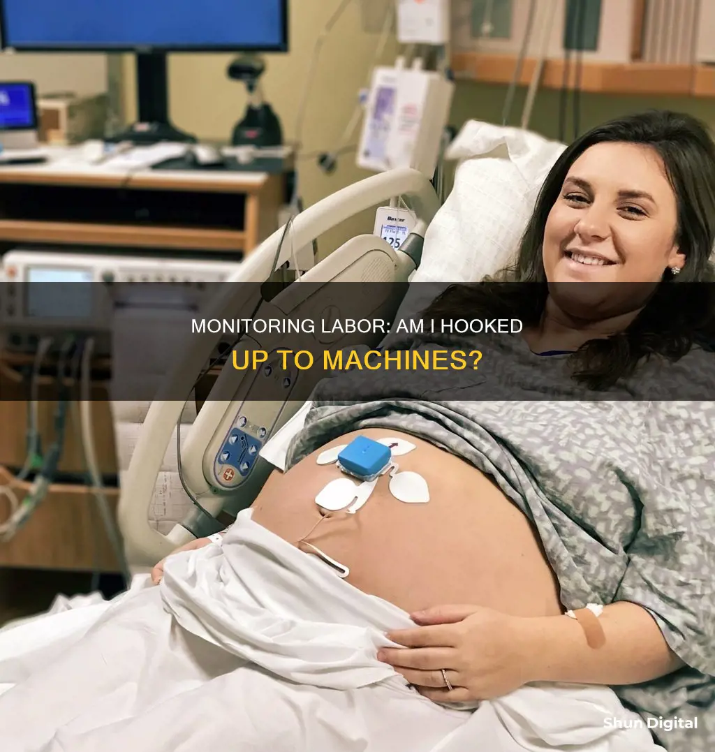 am i hooked up to monitors during labor