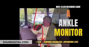 Ankle Monitor: Ellen DeGeneres' Controversial Accessory