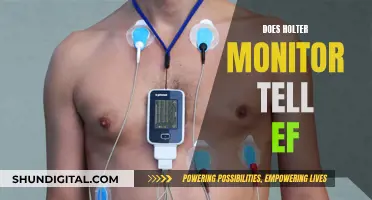 How Holter Monitors Measure EF and Cardiac Health