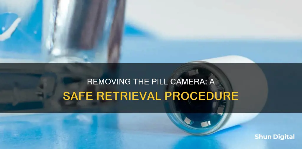 how do they remove a pill camera