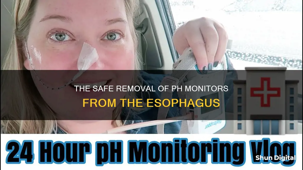 how do they remove ph monitor from esophagus