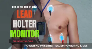 Easy Holter Monitor Setup: 5-Lead Connection Guide