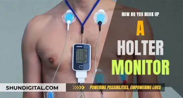 Easy Holter Monitor Application: A Step-by-Step Guide