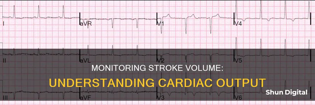 how find out stroke volume from the monitor