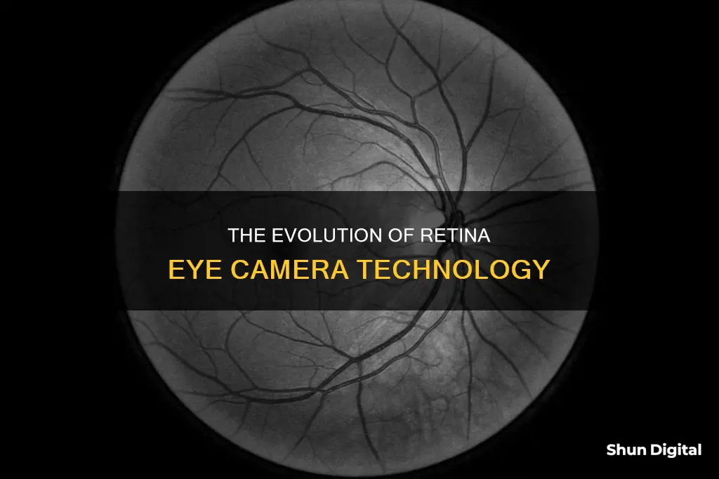 how the retina eye camera was made