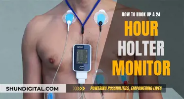 Easy Guide: Wearing a 24-Hour Holter Monitor