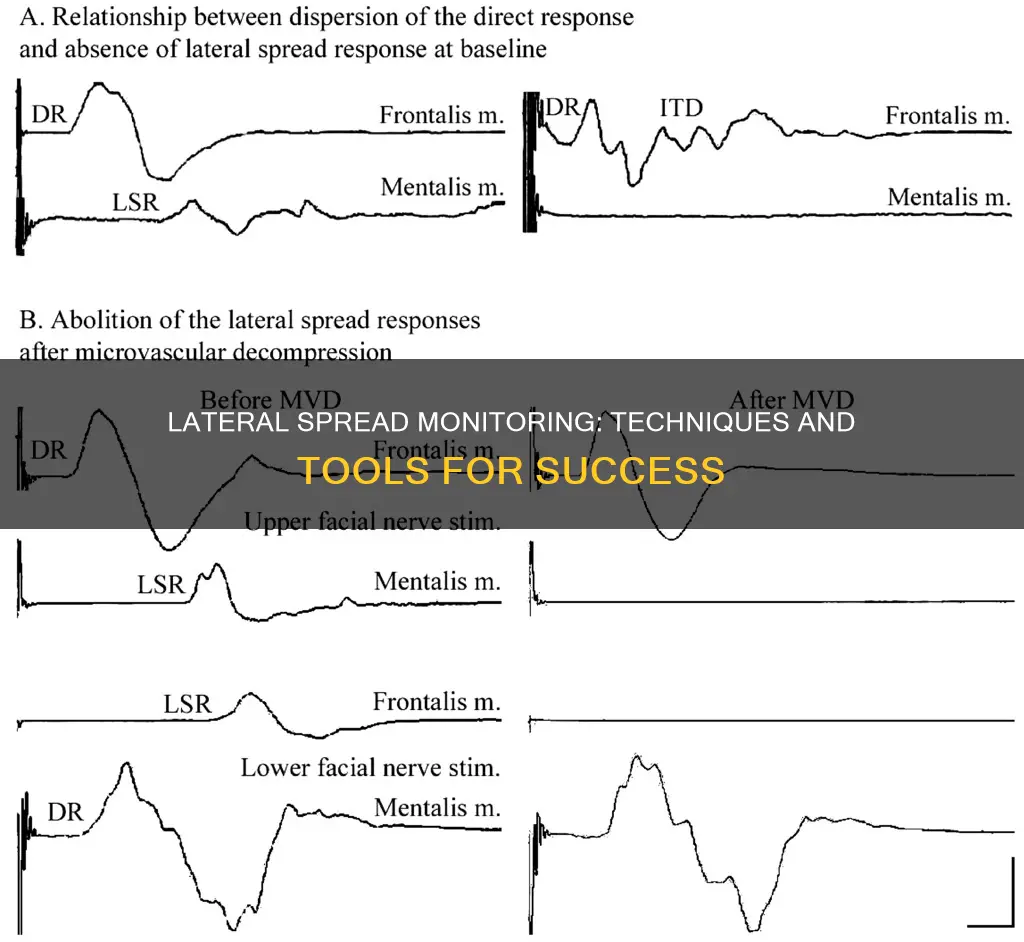 how to perform lateral spread monitoring