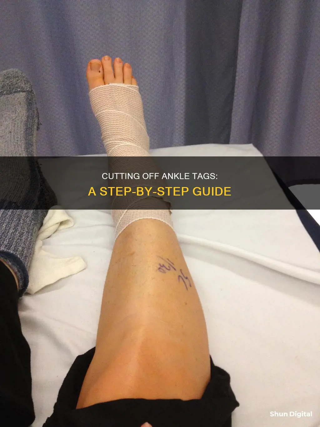 how to remove a electronic monitoring tag from your ankle