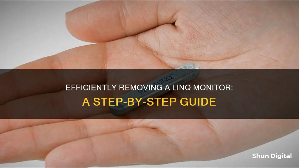 how to remove a linq monitor