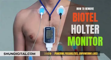 Easy Removal of Biotel Holter Monitor: A Step-by-Step Guide