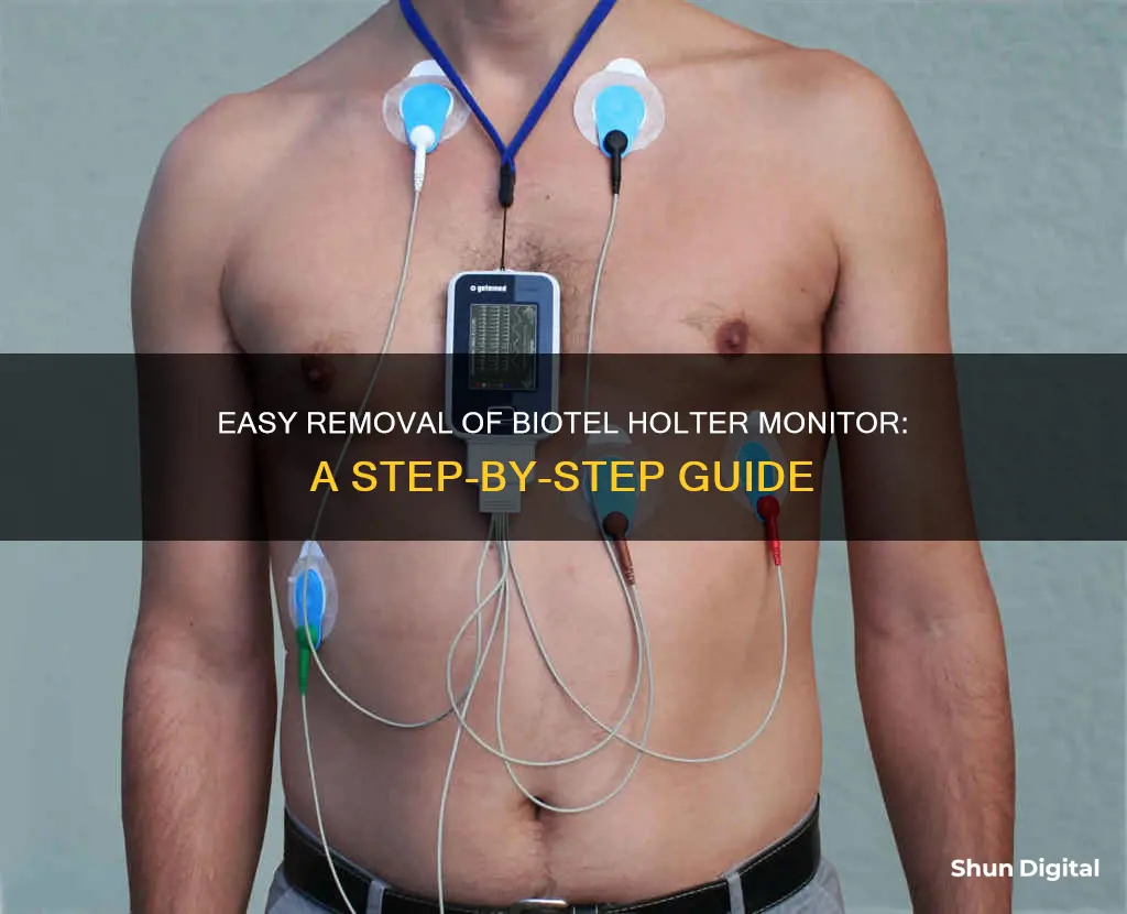 how to remove biotel holter monitor