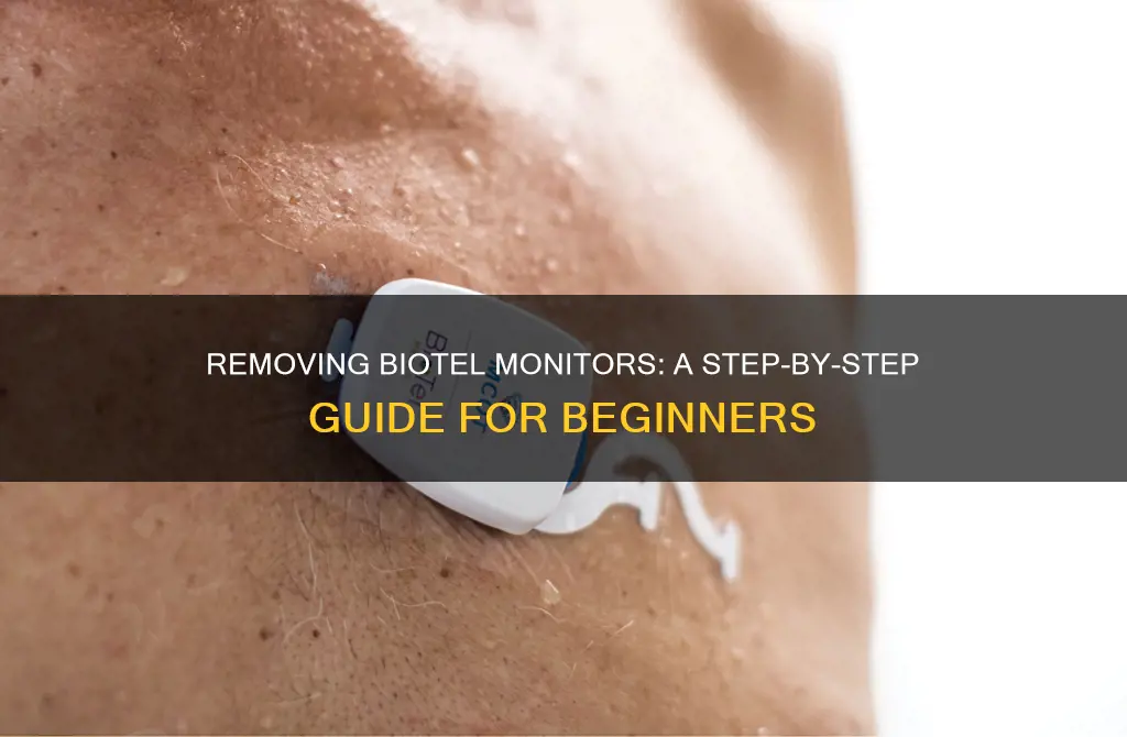 how to remove biotel monitor