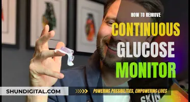 Removing Continuous Glucose Monitors: A Step-by-Step Guide