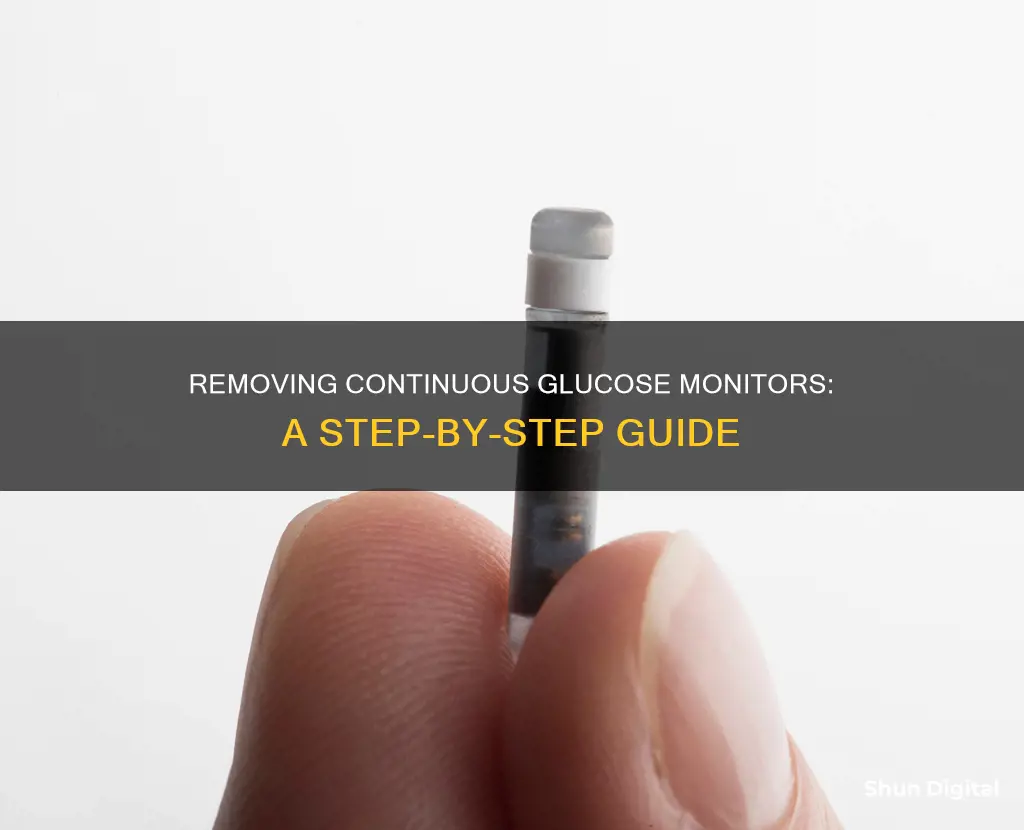 how to remove continuous glucose monitor