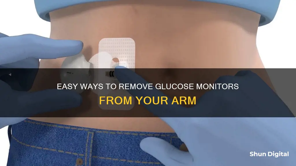 how to remove glucose monitor from arm