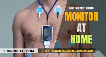 Removing a Holter Monitor: A Simple Guide for At-Home Care