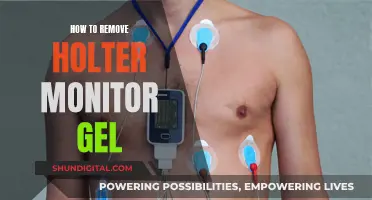 Easy Holter Monitor Gel Removal: Tips and Tricks