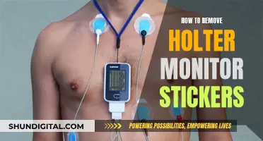 Easy Holter Monitor Sticker Removal: Tips and Tricks