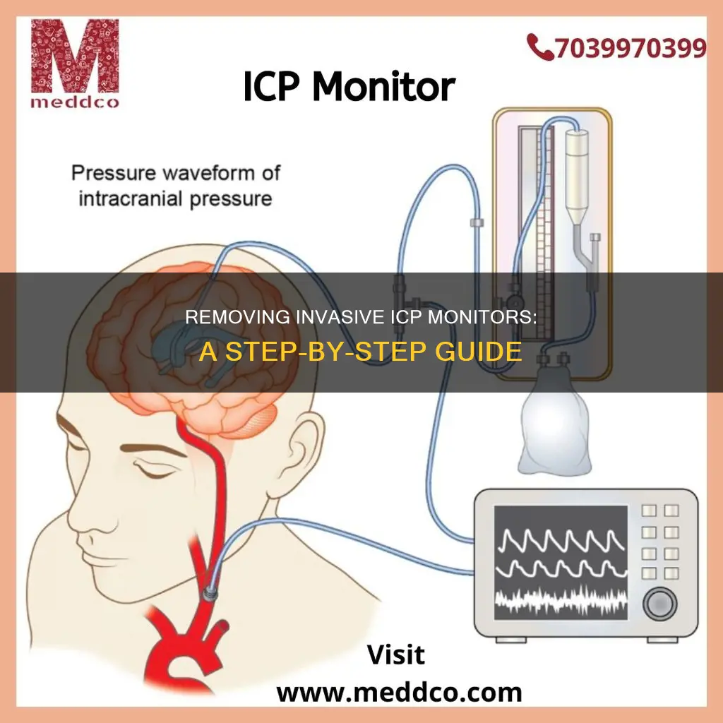 how to remove icp monitor