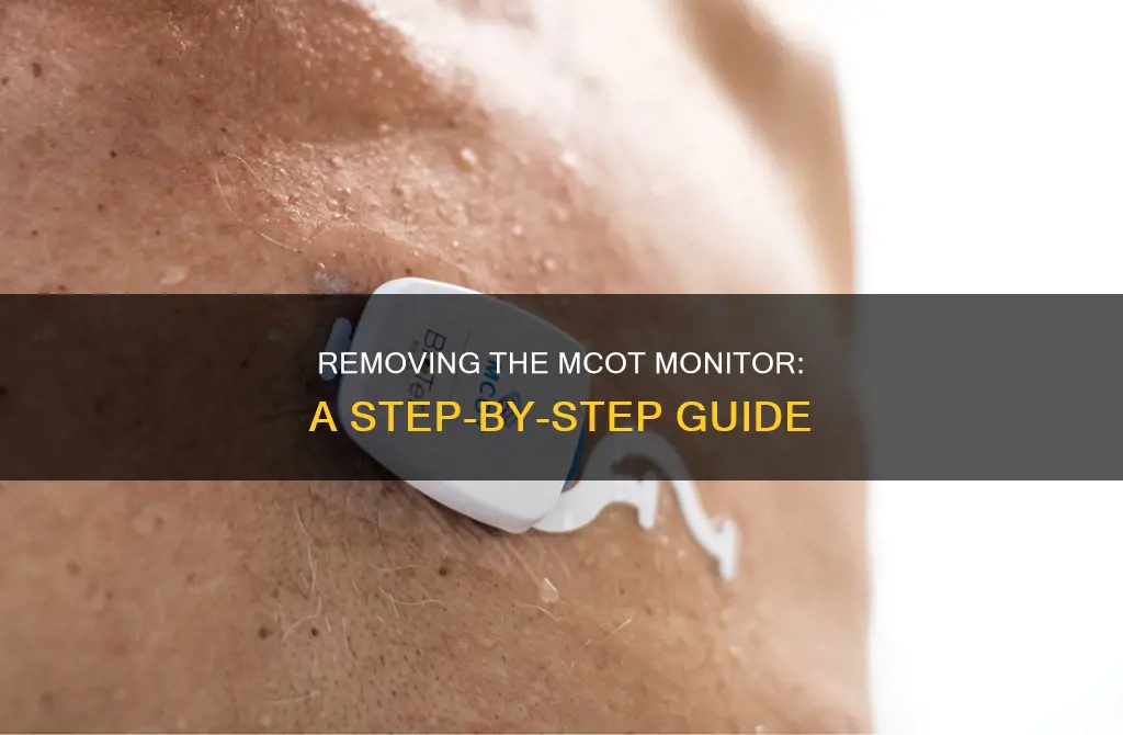 how to remove mcot monitor