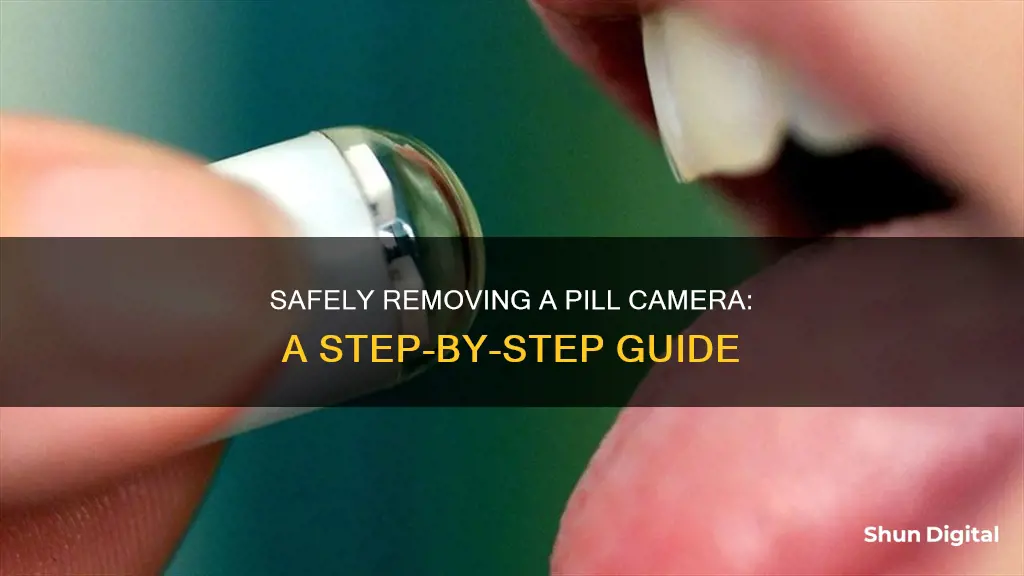 how to remove pill camera from body