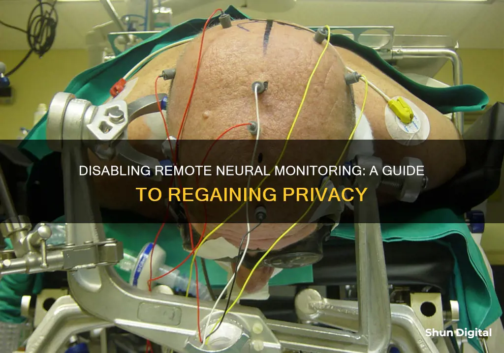 how to remove remote neural monitoring