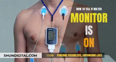 Is Your Holter Monitor On? How to Tell