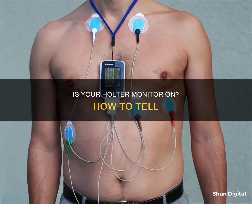 how to tell if holter monitor is on