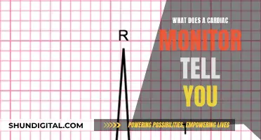 Cardiac Monitoring: Understanding Heart Health and Vital Signs