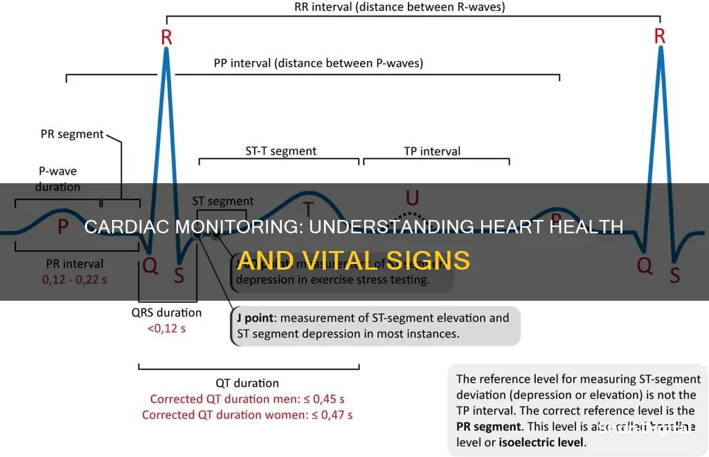 what does a cardiac monitor tell you