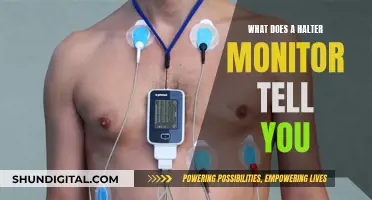 Halter Monitor: What Does It Tell About Your Heart?