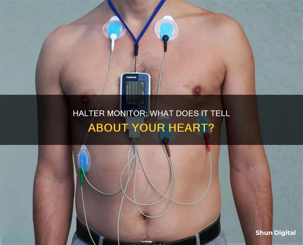 what does a halter monitor tell you