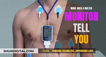 Holter Monitor: Uncovering Heart Health Insights