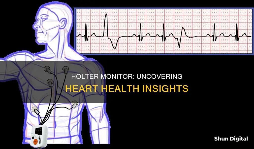 what does a holter monitor tell you