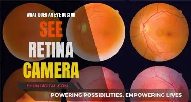 Eye Doctor's Retina Camera: What Does It See?