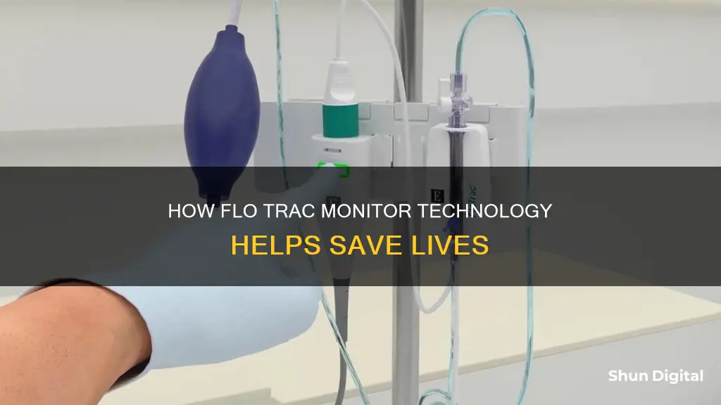 what does flo trac monitor tell you