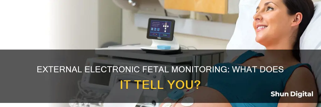 what does the external electronic fetal monitoring device tell you