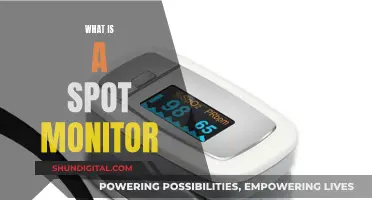 Spot Monitor: What It Is and Why You Need One