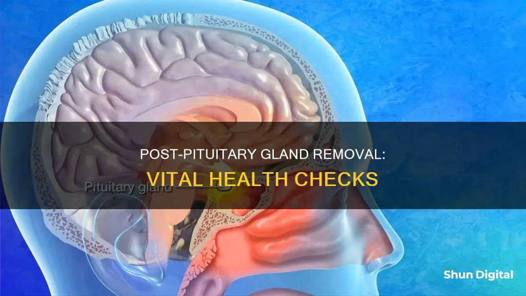 what should be monitored postpituatary gland removal