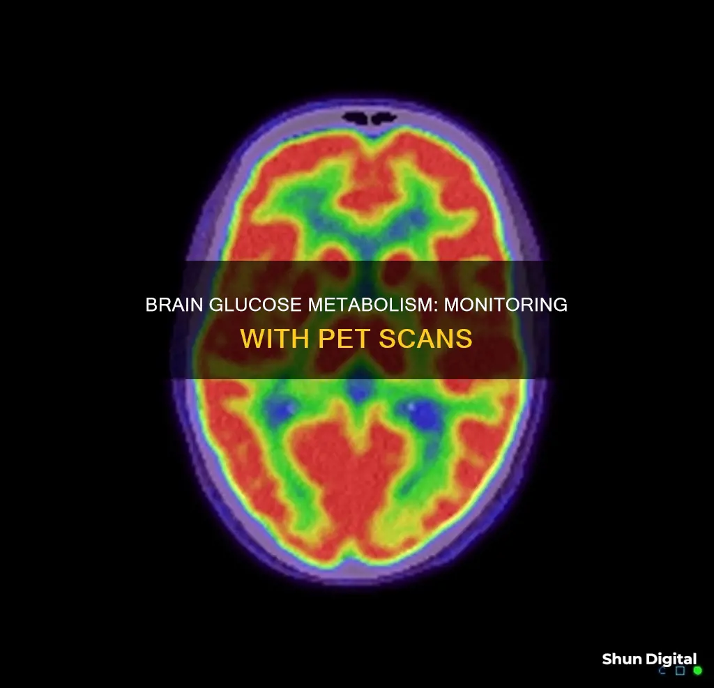 what test monitors the brain