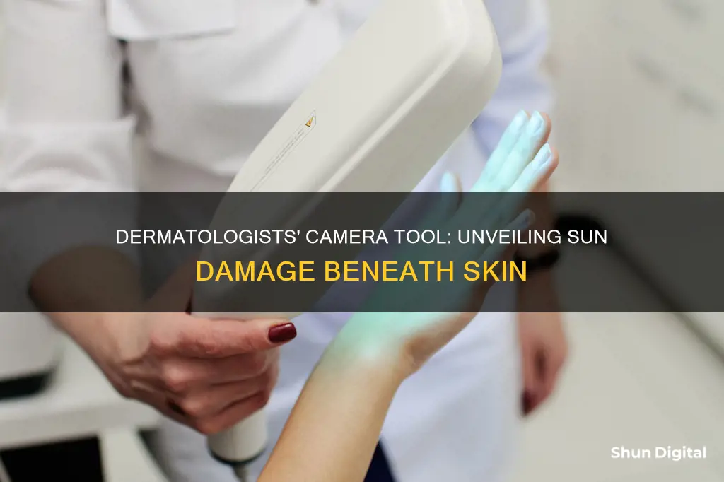 what type of camera sees sun damage with dermatologist