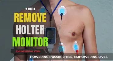 Understanding Holter Monitor Removal: Timing and Procedure