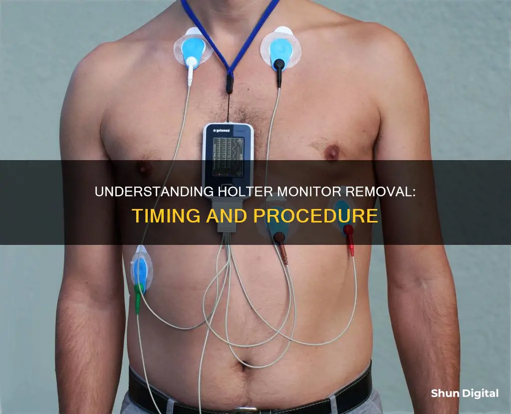 when to remove holter monitor