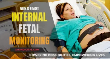 Internal Fetal Monitoring: When to Remove and Why