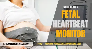 Best Places to Buy Fetal Heartbeat Monitors