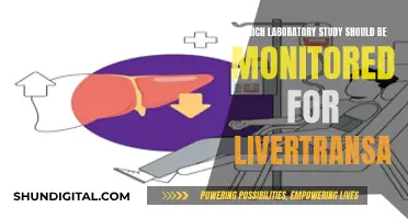 Monitoring Liver Health: Lab Tests for Transaminases