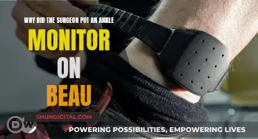 Beau's Ankle Monitor: A Surgeon's Mystery Move