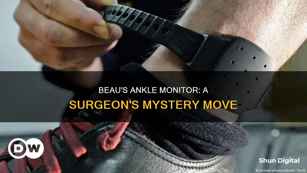 why did the surgeon put an ankle monitor on beau